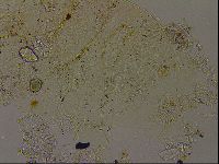 Echiniscus becki image