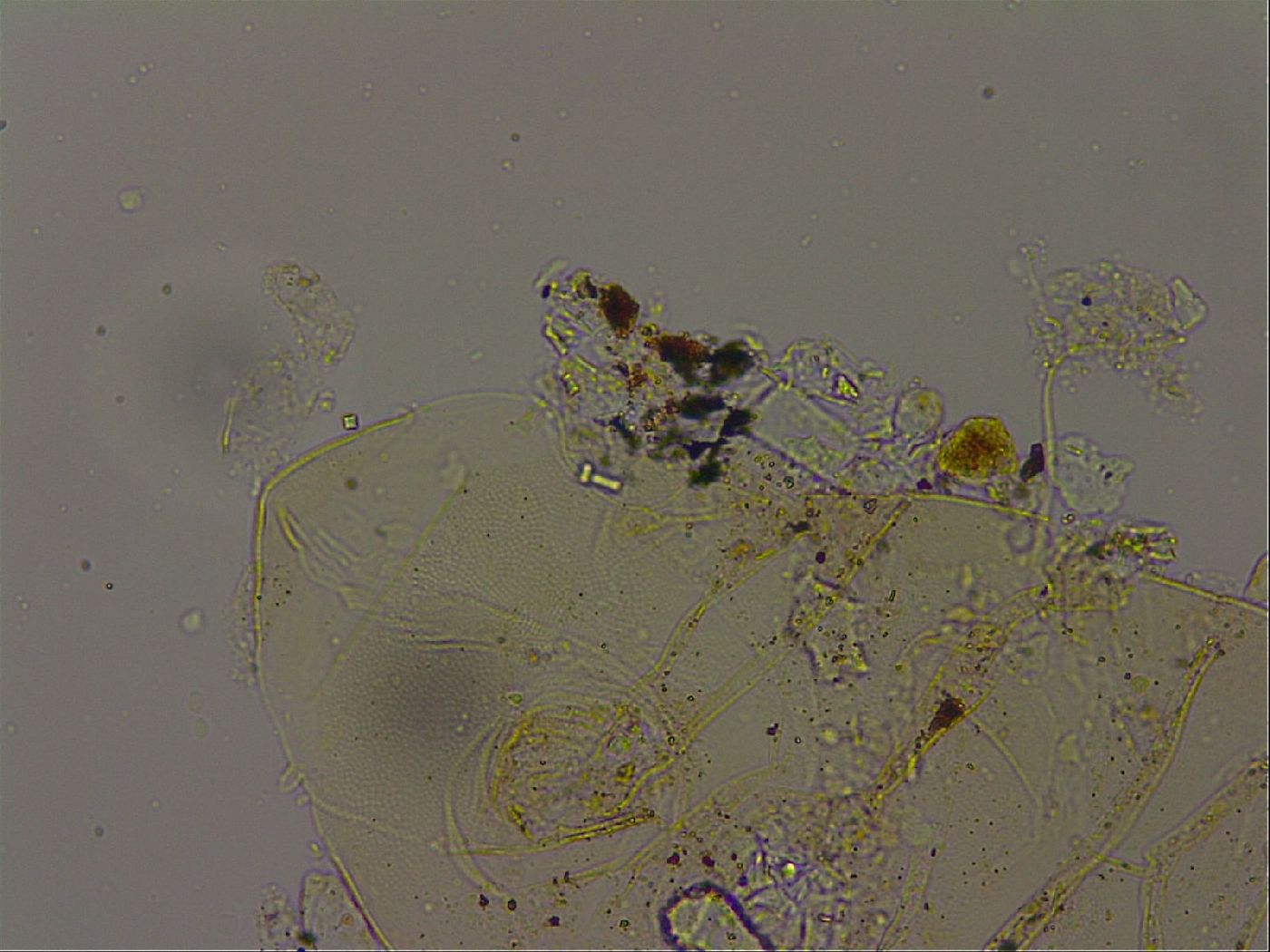 Echiniscus becki image