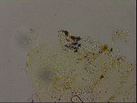 Echiniscus becki image