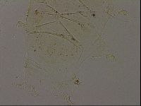 Echiniscus becki image