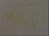 Echiniscus becki image