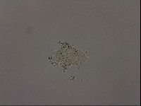 Media resource of Echiniscus becki