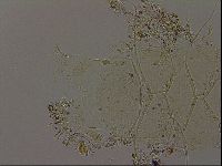Echiniscus becki image