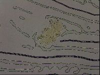 Echiniscus becki image