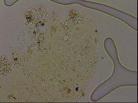 Echiniscus becki image