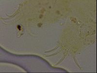 Echiniscus becki image