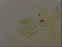 Echiniscus becki image