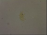 Echiniscus becki image