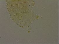 Echiniscus becki image