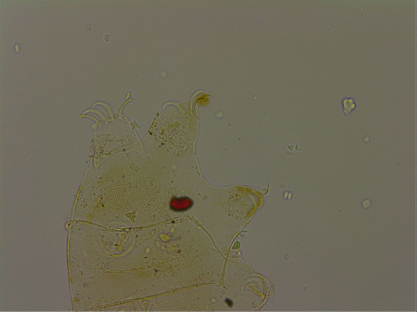 Echiniscus becki image