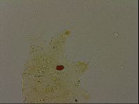 Echiniscus becki image