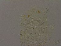 Echiniscus becki image