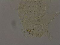 Echiniscus becki image