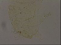 Echiniscus becki image