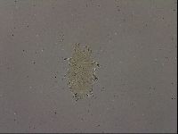 Echiniscus becki image
