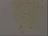 Echiniscus becki image