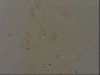 Echiniscus becki image