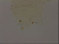 Echiniscus becki image