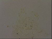 Echiniscus becki image