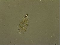 Echiniscus becki image