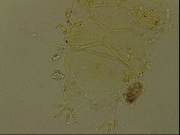 Echiniscus becki image