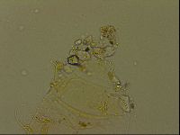 Echiniscus becki image