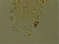 Echiniscus becki image