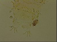 Echiniscus becki image