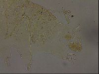 Echiniscus becki image