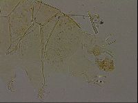 Echiniscus becki image