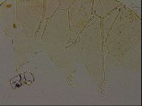 Echiniscus becki image