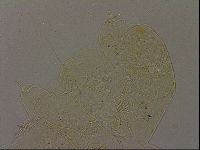 Echiniscus becki image
