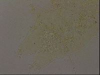 Echiniscus becki image
