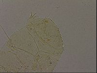 Echiniscus becki image