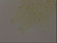 Echiniscus becki image