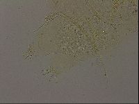 Echiniscus becki image