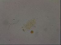 Echiniscus becki image