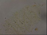 Echiniscus becki image