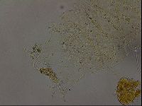 Echiniscus becki image