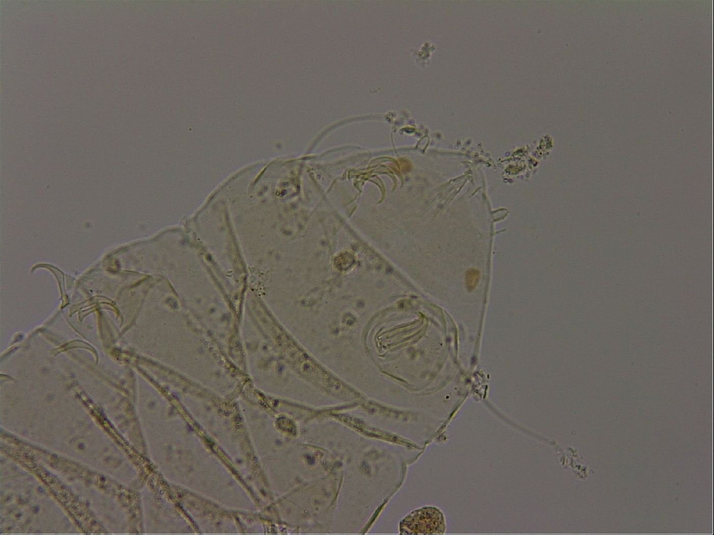 Echiniscus becki image