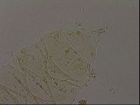 Echiniscus becki image