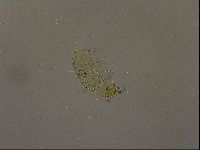 Echiniscus becki image
