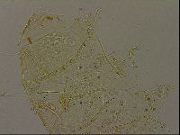 Echiniscus becki image