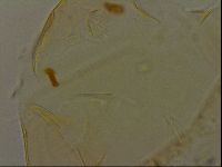 Echiniscus becki image