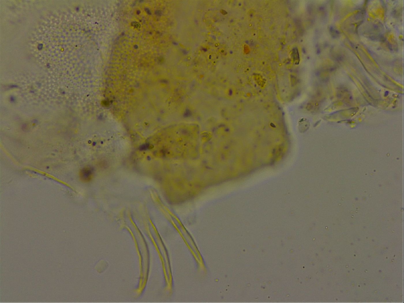 Echiniscus becki image