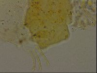 Echiniscus becki image