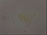 Echiniscus becki image
