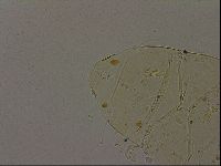Echiniscus becki image