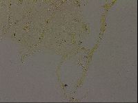 Echiniscus becki image