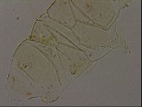 Echiniscus becki image